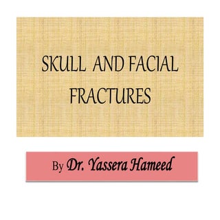 Anatomy of skull fractures
