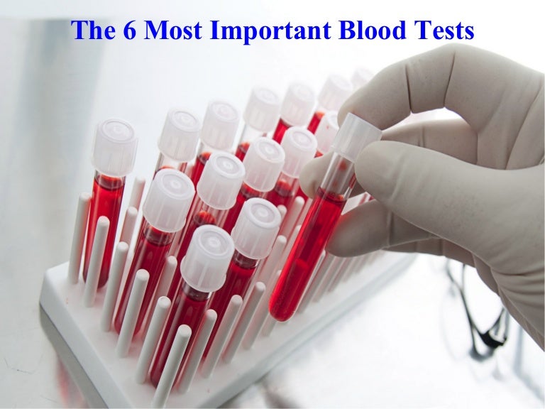 The 6 most important blood tests