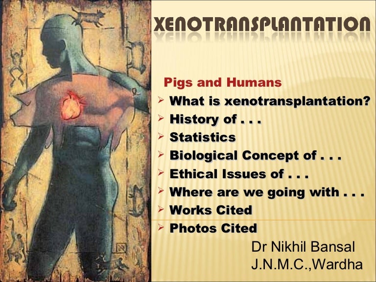 Xenotransplantation