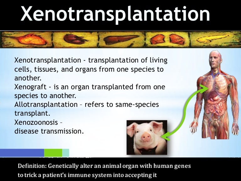 Xenotransplantation