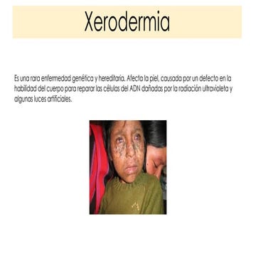XERODERMA PIGMENTOSA | PPTX