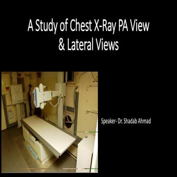 A Study of Chest X-Ray PA View & Lateral Views