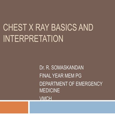 chest X ray basics and interpretation