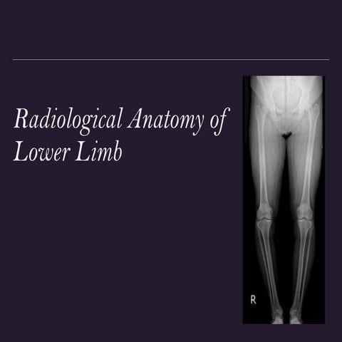 x ray,ct lower limb.pptx lower limb xray