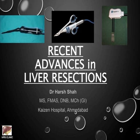 Recent advances in liver resections 