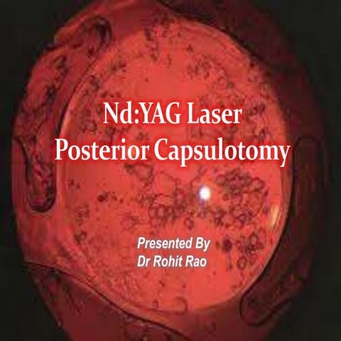Yag capsulotomy