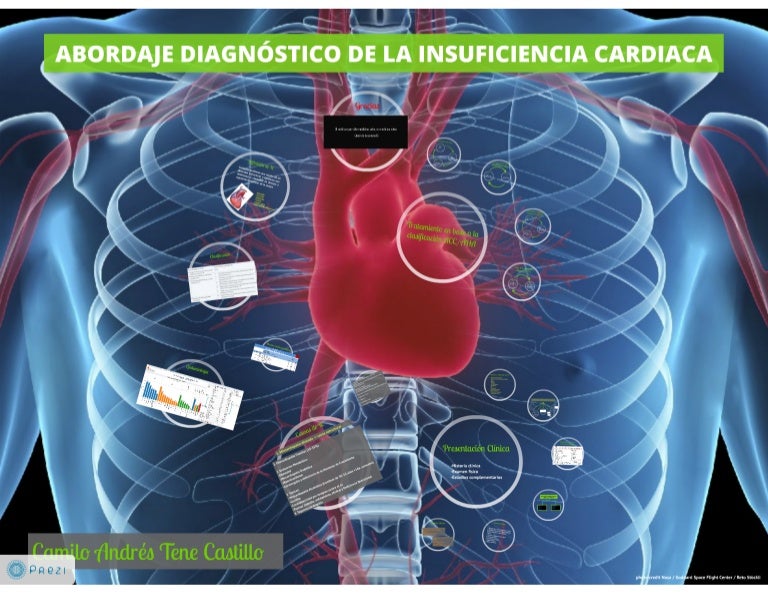 Abordaje diagnóstico y tratamiento de la Insuficiencia Cardiaca 2013