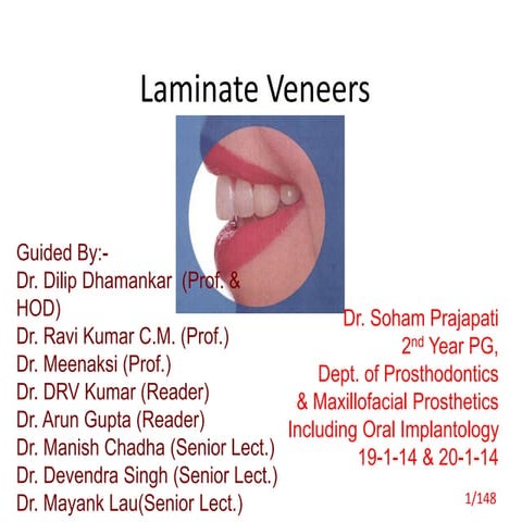 Laminates & Veneers 