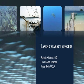 Laser Cataract Surgery the new method to treat cataracts