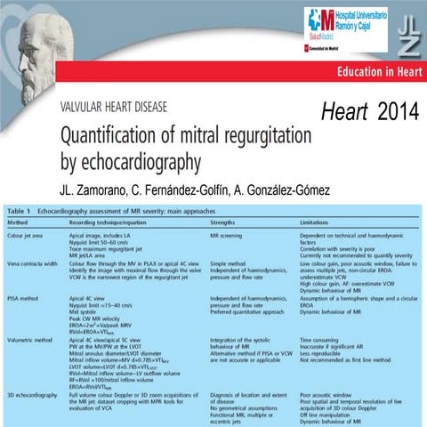 Echocardiography of Mitral regurgitation | PPTX