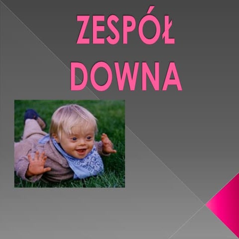 Zespół Downa