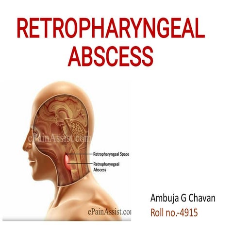 Share_RETROPHARYNGEAL-WPS_Office.pdf abscess of neck | PDF