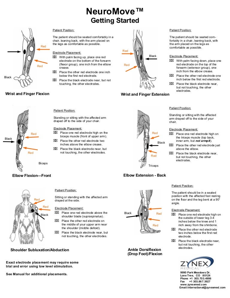 Nmes Electrode Placement Chart