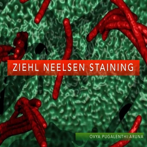 Ziehl neelsen staining 