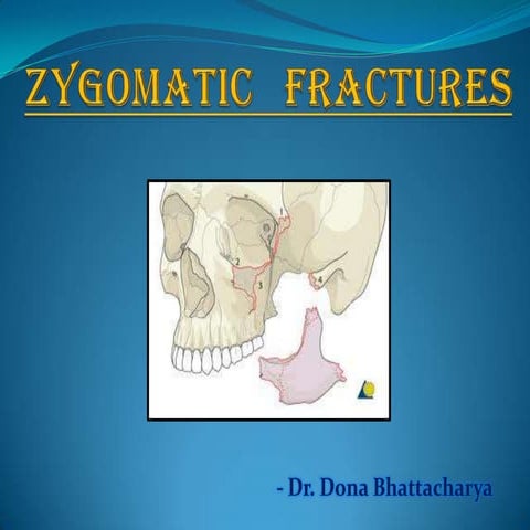 Zygomatic fractures